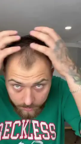 ORDER? KLIK LINK DI BIO!!! #Toppik #HairFiber #PenebalRambut #SolusiRambut #Kebotakan #RambutTipis #Review #Hairstyle #HairTok #ForYou #BeliLokal #ForYouPage 