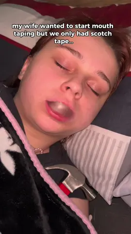 Instantly stops snoring and mouth breathing🤯🤯 #snoring #snoreclips #mouthbreathing #sleepapnea #snoringhusband  