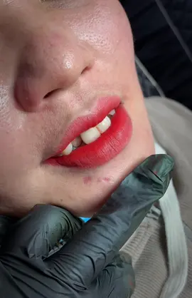 cấy môi tan viền đi người đẹp #phunmoi #phunmoidep 