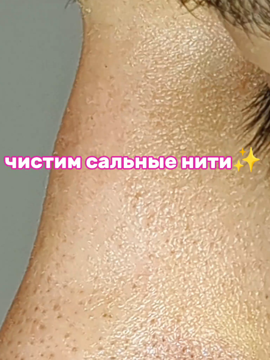 ASMR✨ уговорила наконец-то🥰 УЗ #уходзакожей #сальныенити #чистаякожа #черныеточки 