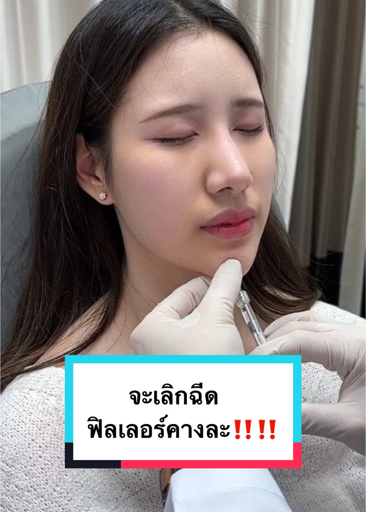 ไม่อยากฉีดฟิงเลอร์คางแล้ว ถ้ารู้ว่าจะเป็นอย่างนี้😏🤨 #รีวิวคลินิก #รีวิว #รีวิวบิวตี้ #รีวิวของดีบอกต่อ #รีวิวฉีดหน้า #รีวิวไปเรื่อย #รีวิวบิวตี้ในtiktok #รีวิวสกินแคร์ #ฟิลเลอร์ #รีวิวฟิลเลอร์ #ฟิลเลอร์คาง #คางตัด #คางทู่ #คางเรียว #คางสวย #คางสวยวีเชฟ #รีวิวฉีดฟิลเลอร์ #หน้าเรียว #หน้าวี #หน้าบาน 