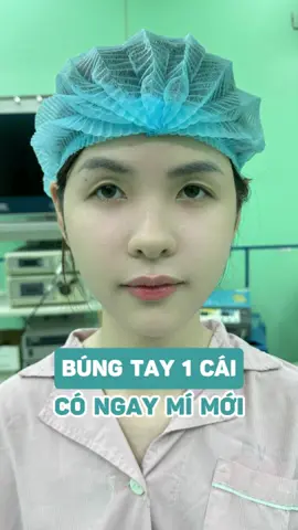 Búng tay 1 cái … #bacsiyenchuyencatmi #catmitunhien #nhanmi #thammymat 