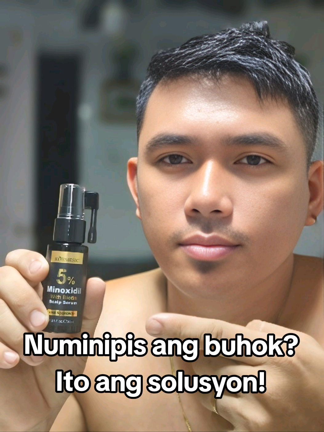 Numinipis ang buhok? May solusyon jan! Try mo to para makita mo ang results!. #hairgoals #hairspray #kormesic #Minoxidil #fyp  #CapCut 