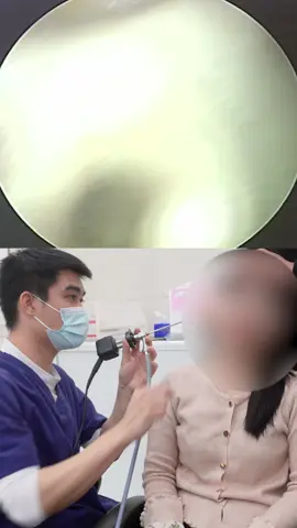 Viêm ống tai ngoài. Bệnh của mùa hè #xuhuong #xuhuongtiktok #layraytai #hocxuong #hocxuongca #layraytaicocamera #layraytaichobe #layraytaicucphe #viemtai #viemtaigiua #viemmuixoang #viemmuixoangtreem