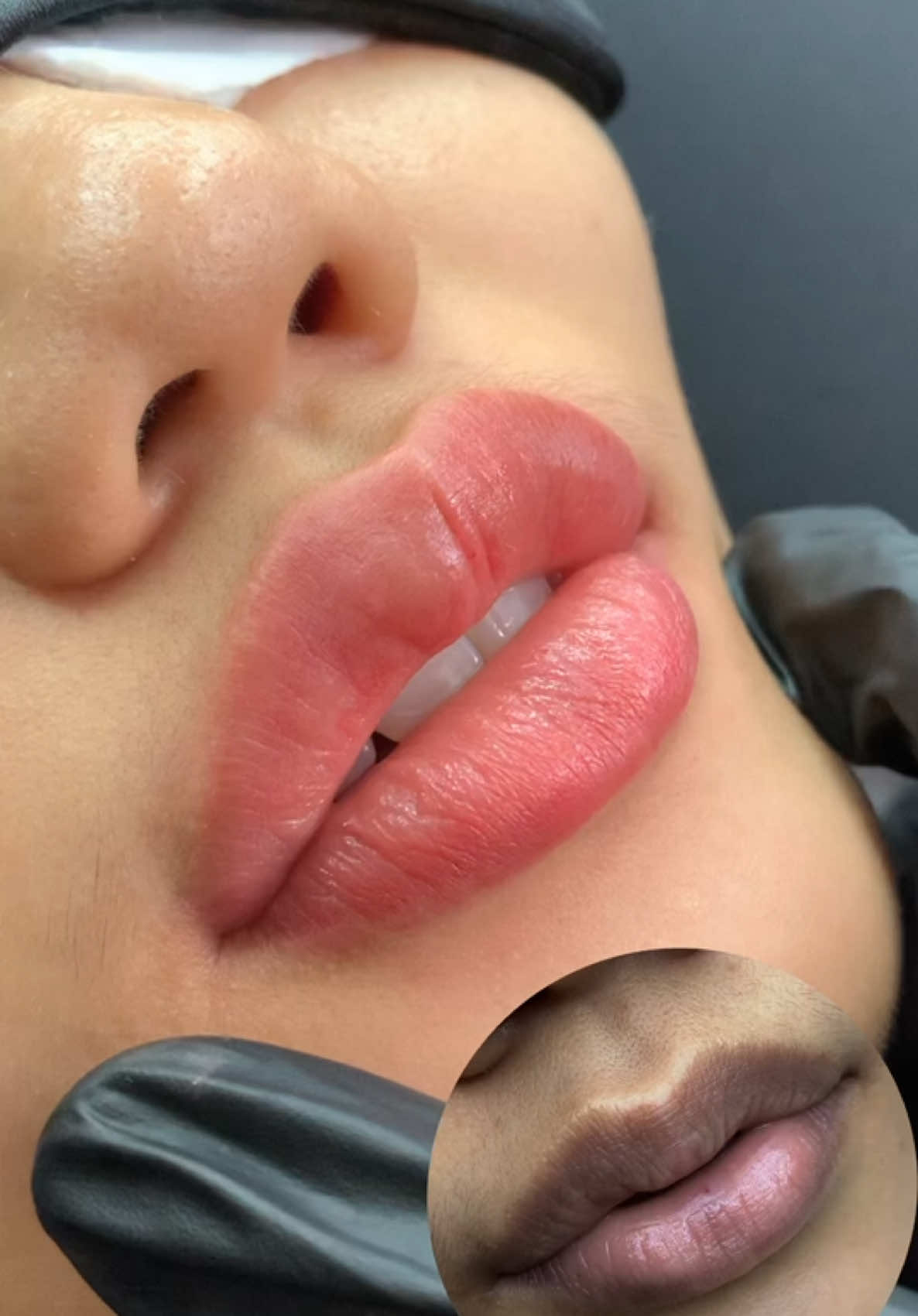 “Bong hay chưa bong??? Môi khử thâm siêu mịn, không cặn mực, chuẩn kỹ thuật LiseLips nha!” #phunmoi #khuthammoi #phunxamsaigondep #phunmoitunhien #khuthammoinam #moixinh #chanmaydepsaigon #phunmoidep #phunmôicollagen #phunxamdepsaigon #phunxamsaigon #phunmoigiare #molisebeauty #moidep #khutham 