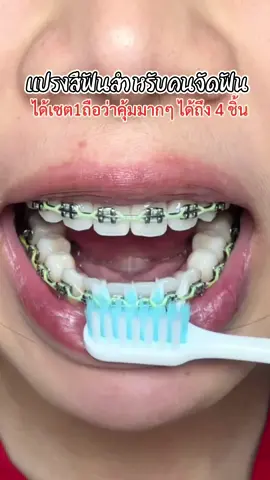 นี่แหละปัญหาคนจัดฟันได้เซตนี้ไปคุ้ม 🤭##คนจัดฟัน##เเปรงจัดฟัน##จัดฟัน##แปรงฟัน#ไอเทมคนจัดฟัน##buoola