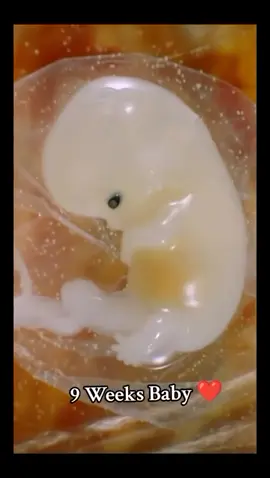 ✨ Di usia 9 minggu janin kecil dalam rahim sudah berkembang luar biasa!   - Jantungnya sudah berdetak kuat.   - Wajah mungil mulai terbentuk: mata, hidung, mulut, bahkan lidah!   - Tangan dan kaki mungil sudah mulai bisa bergerak.   - Organ-organ vital seperti otak, hati, dan ginjal mulai bekerja keras. Di masa ini, janin sudah merasakan getaran emosi dari ibunya.   Apa yang ibu pikirkan, rasakan, dan alami — akan terekam dalam ingatan bawah sadar janin. Itulah sebabnya hypnotherapy untuk ibu hamil sangat penting.   Menurut Oma, melalui hypnotherapy, ibu bisa:   - Menenangkan pikiran,   - Menanamkan afirmasi positif,   - Membangun koneksi cinta mendalam dengan janin. Karena pikiran yang damai akan menjadi hadiah pertama bagi buah hati tercinta. Bersama Oma Lanny, mari belajar membangun lahir batin si kecil sejak dalam kandungan.   Hypnobirthing bukan hanya teknik — ini adalah perjalanan cinta. Sumber video : baby_mama3498 #HypnobirthingOmaLanny #9Minggu #HypnotherapyKehamilan #KoneksiIbuJanin #cintasejakdalamrahim 