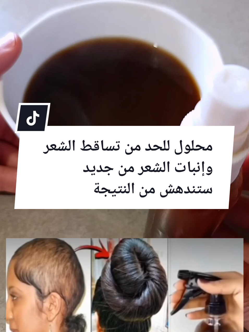 #محلول للحد من تساقط الشعر وإنبات الفراغات من جديد ستندهش من النتيجة #تطويل#تنعيم#انبات-الفرغات#تساقط-الشعر-انبات-الشعر-تطويل-الشعر#وصفة#طبيعية#مجربة#وصفاتي#طبيعية#foryoupage#marocaine🇲🇦 #france🇫🇷 #foryoupage #الشعب_الصيني_ماله_حل😂😂 