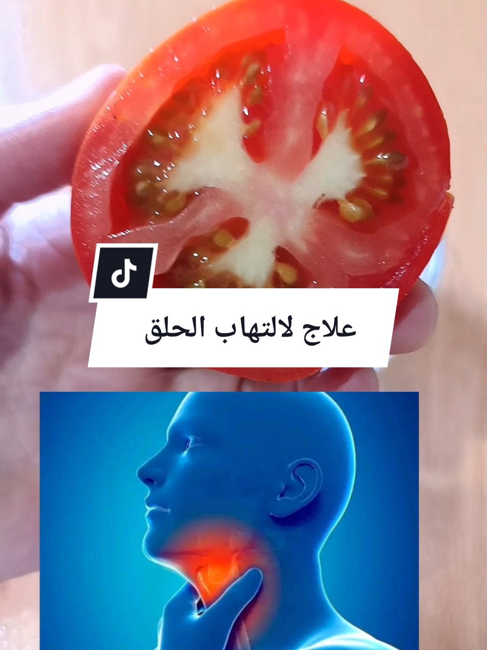 #علاج طبيعي لالتهاب الحلق #علاج -الم#الحلق #اللوزتين #علاج #طبيعي #marocaine🇲🇦 #aljiryyá🇩🇿ماهر #antibiotiquenaturel #antibiotiquenatur 