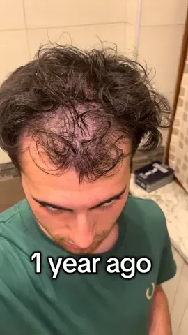‎فوائد السدر للشعر بضمان %100 ‎لاتحتاج للعملیە زرع الشعر بعد الان  ‎▪️یحیی جذور المیتة و یطلع شعرات جدیدة  ‎▪️یرجع شعرك  ‎▪️یمنع من تصاقط ‎▪️ترطيب الشعر  ‎▪️تقوية الشعر والحماية من التساقط  ‎▪️اعادة اللمعان للشعر  ‎▪️زيادة كثافة الشعر  ‎▪️علاج الشعر التالف  ‎▪️التخلص من القشرة ‎◾️تقويه بُصيلة الشعر  ‎يعمل السدر على تقوية الشعر حيث يقوي جذوره و البصيلات الضعيفه . ‎يجعل الشعر اكثر كثافه وحيوية . ‎يعطي السدر الشعر لمعاناً وبريقاً و جمالاً . ‎يساعد السدر على تعزيز بصيلات الشعر من الجذور حتى الاطراف ليصبح اكثر كثافةً وحجماً ‎گـەڵای ســـــیدر  ‎‏‎✹✹ سوودێکی سەرەکی و گرنگی ئەوەیە کە نایابە بۆ هێنانەوەی مووی سەر و بەهێزکردنی قژ. ‎سدر موعجیزەکەی قژ.. و ترێندەکەی ئێستا. ‎‏‎بۆ هەردوو ڕەگەز گونجاوە👫 ‎‏‎بۆ هەموو تەمەنێک دەبی ‎‏‎سودەکانی سدر 💯 ‎‏‎1. بۆ درێژبوونی قژ و پڕبوونی قژ. ‎‏‎2. قژ بەهێز و ئەستوور دەکات. ‎‏‎3. نەرمی و بریقە بە قژ دەبەخشێ. ‎‏‎4. پێستی سەر خاوێن دەکاتەوە بەبێ ئەوەی چەوری بەسوودی لێ بماڵێت. ‎‏‎5. گەشەی قژ زیاددەکات و ڕێگری لە هەڵوەرینی قژ دەکات. ‎‏‎6. پڕبونی ڕیش و برۆ. ‎‏‎7. خۆراک و کانزا و ڤیتامین ئەبەخشێ بە پێست و قژ بەهۆی پێکهاتە تایبەتەکەی. ‎‏‎8. پارێزگاری لە پێست لە سەدەفی و ئەکزیما دەکات. ‎‏‎10. وەک ماسک بەکاریەتەوە، بێ ڕەنگە قژ ڕەنگ ناکات. بۆ قژی ڕەنگکراو دەبێت. ‎ڤیتامینەکانی ناو سدر: A + C + E + B1-B6 ‎کانزاکانی: کالسیۆم + مگنسیۆم + ئاسن + ساپۆنین + فلڤۆنۆید