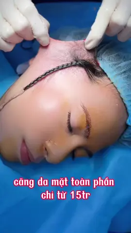 căng da mặt toàn phần#Danemark 