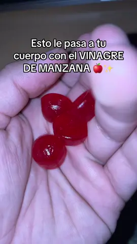 Amo el Vinagre de Manzana #vinagredemanzana #gomitasvinagredemanzana #vinagredemanzanabeneficios 