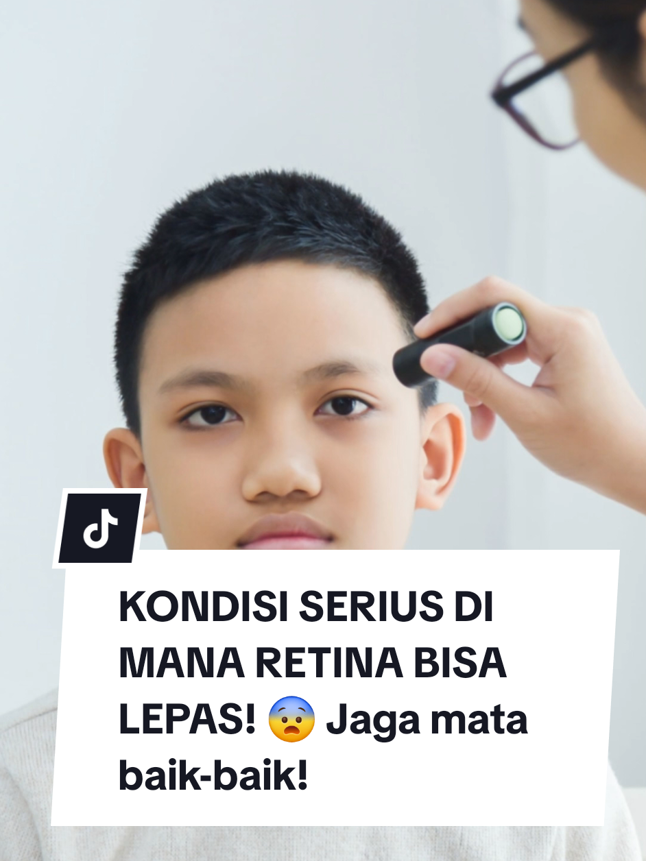 Jangan Anggap Remeh Mata Minus Tinggi! 😥 Kalau Udah Lebih Dari 8, Risikonya Bisa Serius! 😟 #promomakangajian #freshvision #madumata #madumata #wortel #blueberry #freshvisionoriginal #tipskesehatanmata #kesehatanmata #madu 