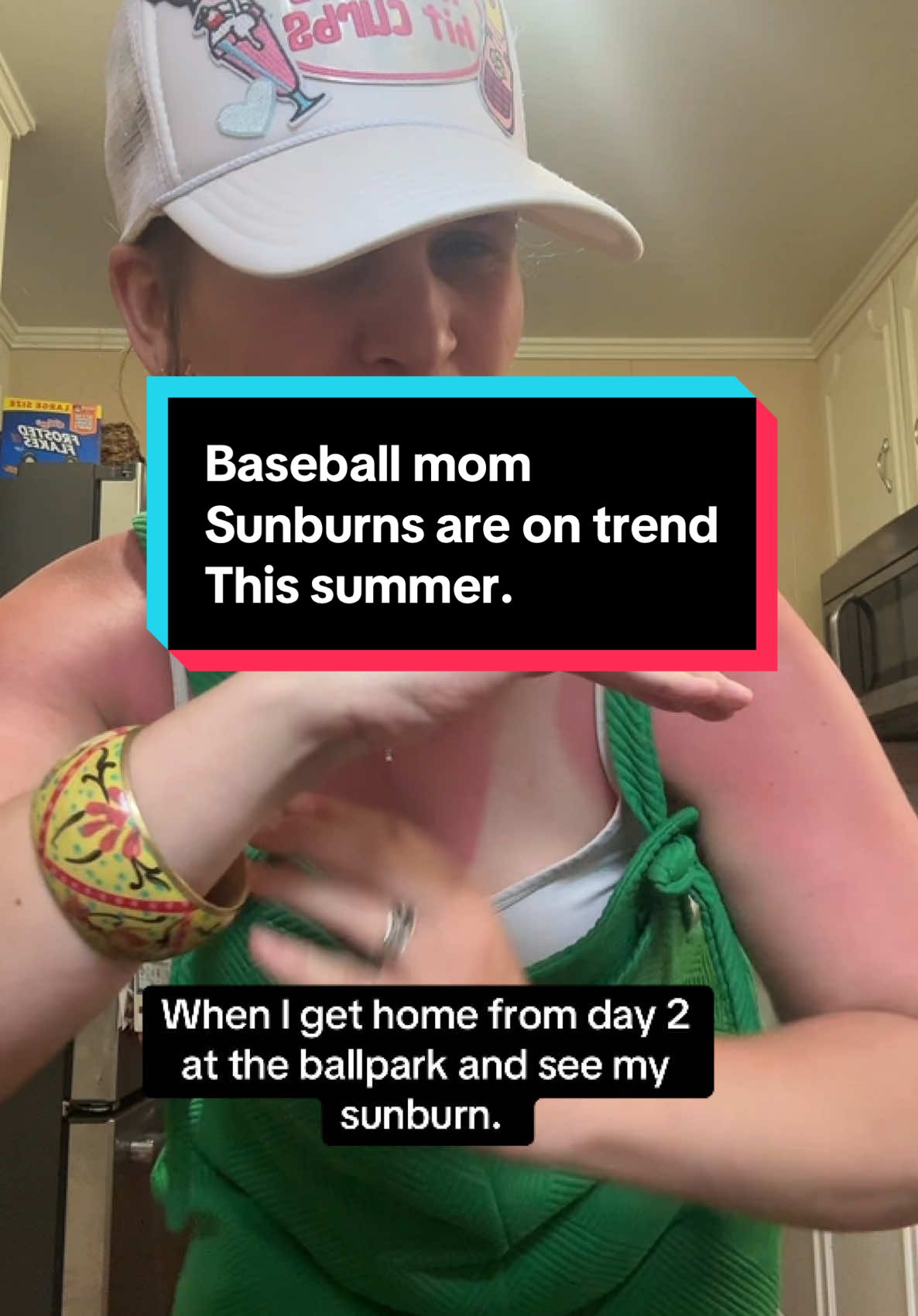 Please tell me what to do to get this sunburn gone!!!! #sunburn #sun #baseballlife #baseballszn #baseballmom 