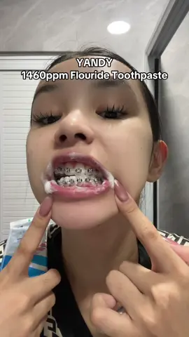 Try this! #toothpaste #braces #brace #toothdecay #cavity 