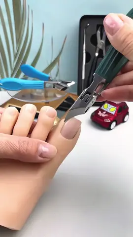 ¡Dile adiós a las uñas encarnadas y gruesas! Este cortaúñas de apertura ancha corta sin esfuerzo incluso las uñas más duras, con precisión y sin ensuciar gracias a su sistema de recolección automática. ¡Imprescindible para un cuidado perfecto de las uñas! 👣✂#CortaUñasDeAperturaAncha #SoluciónParaUñasEncarnadas #CortadorDeUñasGruesas #CuidadoDeUñasFácil #EsencialesDeHigiene #HerramientaImprescindible #CortePreciso #SinDesorden #FácilDeUsar #MejorCompra #TendenciaEnTikTok #ProductoViral #compraahora