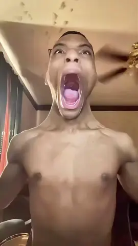 Day 1 of daily funny Neck guy😂 …  . : : . . #funnyvideo #funny #funnyvideos #memes #funnymemes #meme #comedy #funnymeme #viral #memesdaily #funnyshit #fun #video #dankmemes #tiktok #lol #comedyvideos #trending #funnyposts #jokes #funnyvids #humor #comedyvideo #like #laugh #explorepage #funnyclips #instagram #explore 