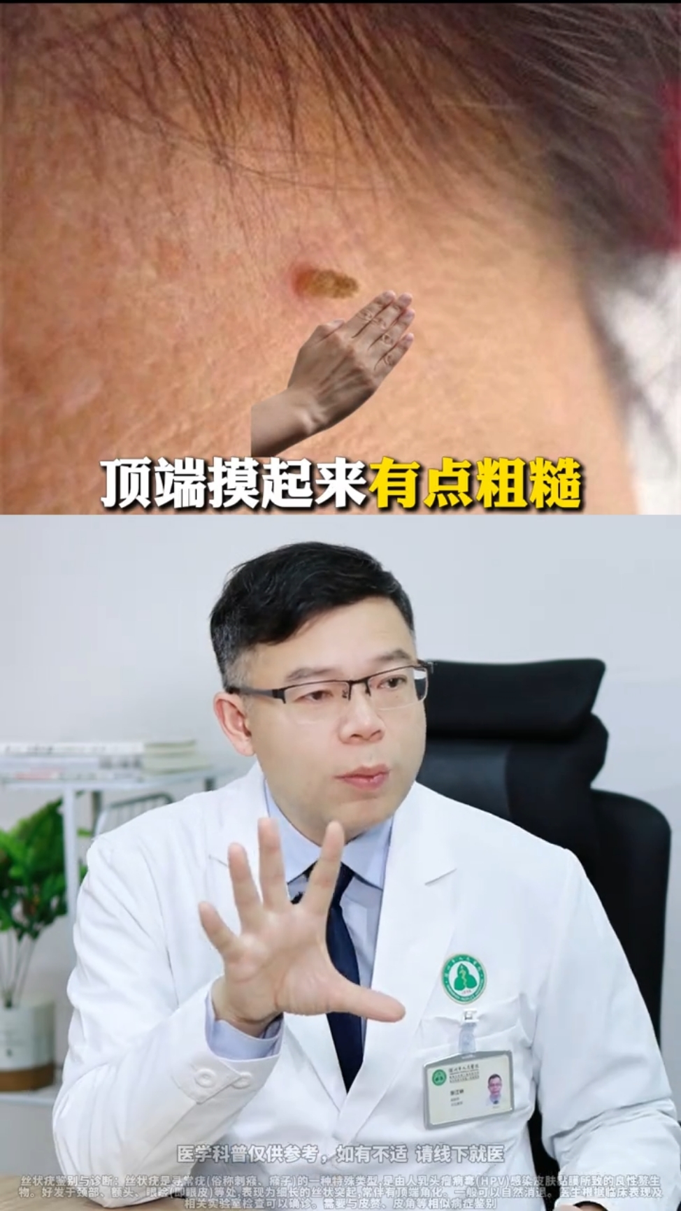 腋下小肉粒千万不要剪，这可全身病毒，像这种小肉粒，摸起来还有点粗糙，这就是人乳头病毒感染#健康 #分享#新知识#医生#病毒