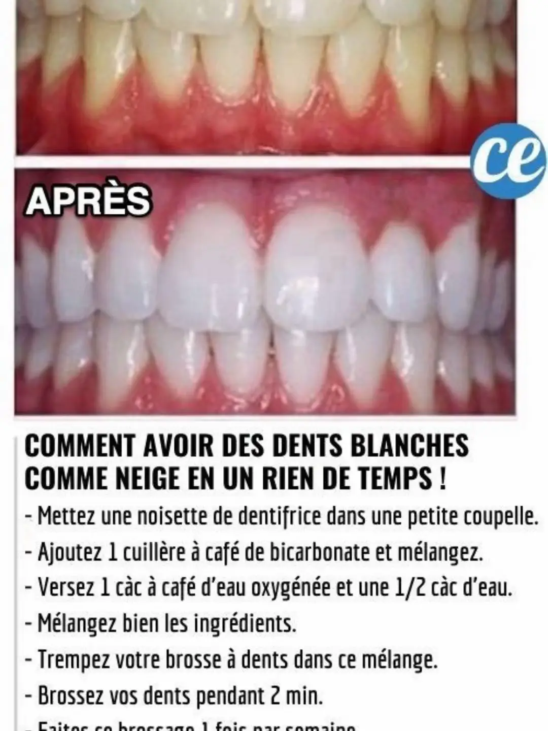 Tu attends quoi pour t abonné pour plus astuce  #soins #SmallBusiness #visage #dentist 