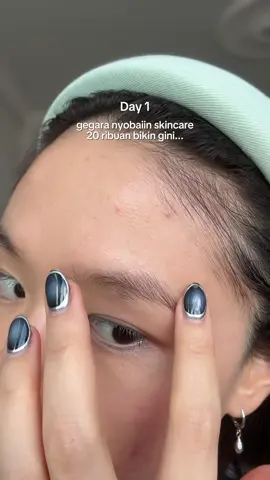 Jangan tunggu sampe jerawat menyebar luas, yuk Prevent, Fight, and Reduce acne with Hanasui Acne Expert Set now!🥊 #Hanasui #HanasuiAcneExpert @Hanasui Official 