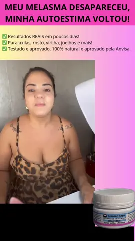 Cliente satisfeita com Cicatridiva ❤️💯 #clareiamanchas #entregaem24horas #paguenaentrega #adeusmelasma #Cicatridiva #melasmatratamento 