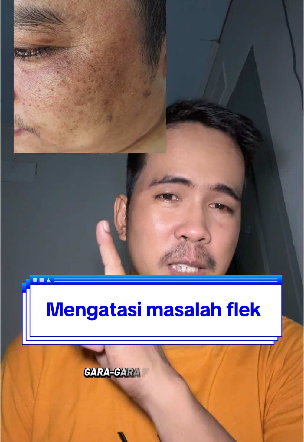 Mengatasi masalah flek hitam jangan di perbanyak skincarenya justru pakai yang skincare basic aja, facialwash, moisturizer, dan sunscreen #sunscreen #moisturizer #facialwash #flekhitam @dr.Tompi  