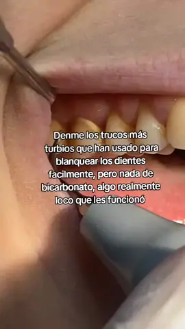 #dientes #parati #fypシ #viral #ponmeenparati #fyppppppppppppppppppppppp #chisme #xybca #chismesito #fyp 