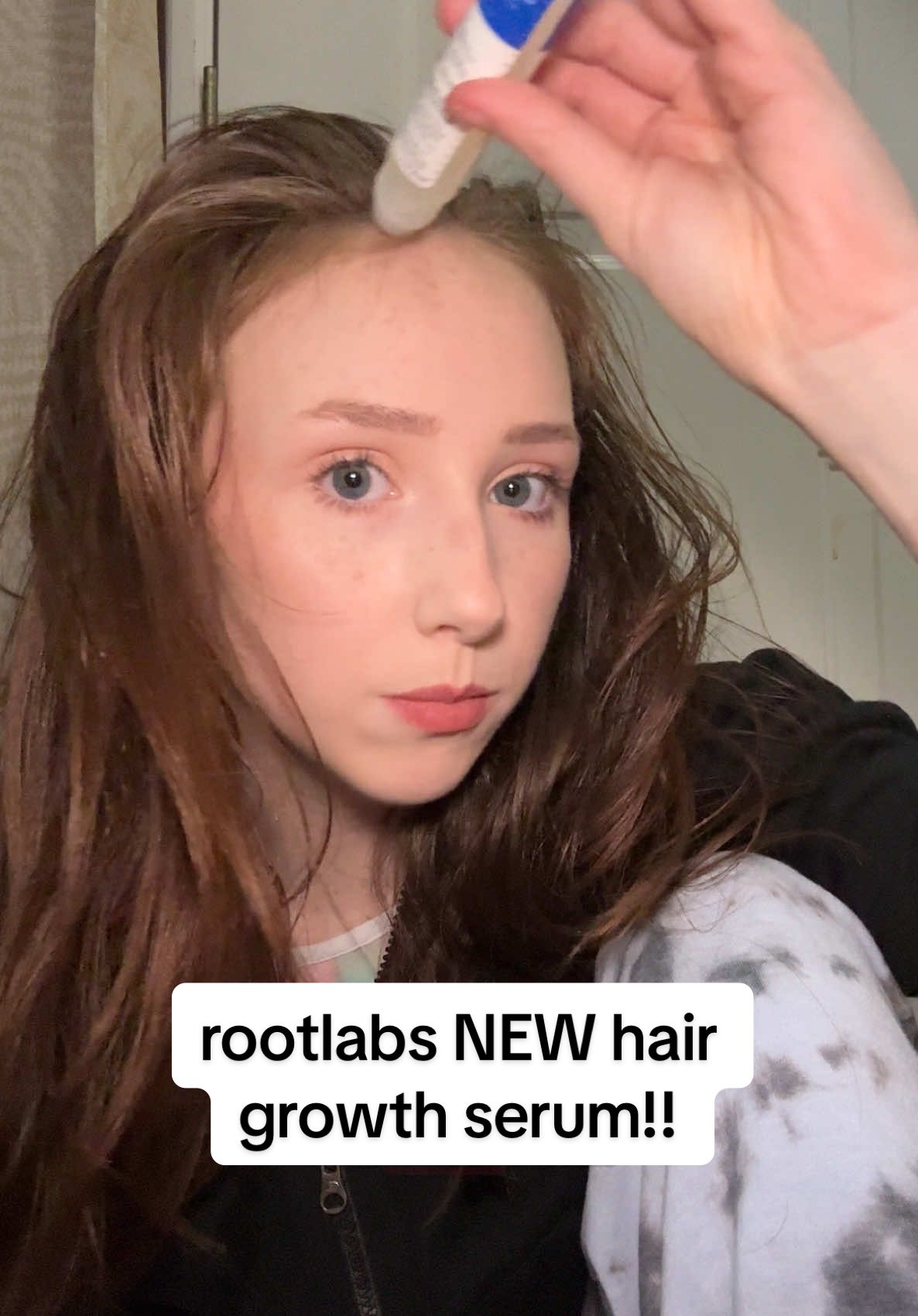 quick and efficient hair growth serum! i’m loving it so far #hairgrowth #hair #haircare #hairserum #hairoil #scalphealth #scalpoil #rootlabs #bodywise @RootLabs #creatorsearchinsights #hairgrowthserum 