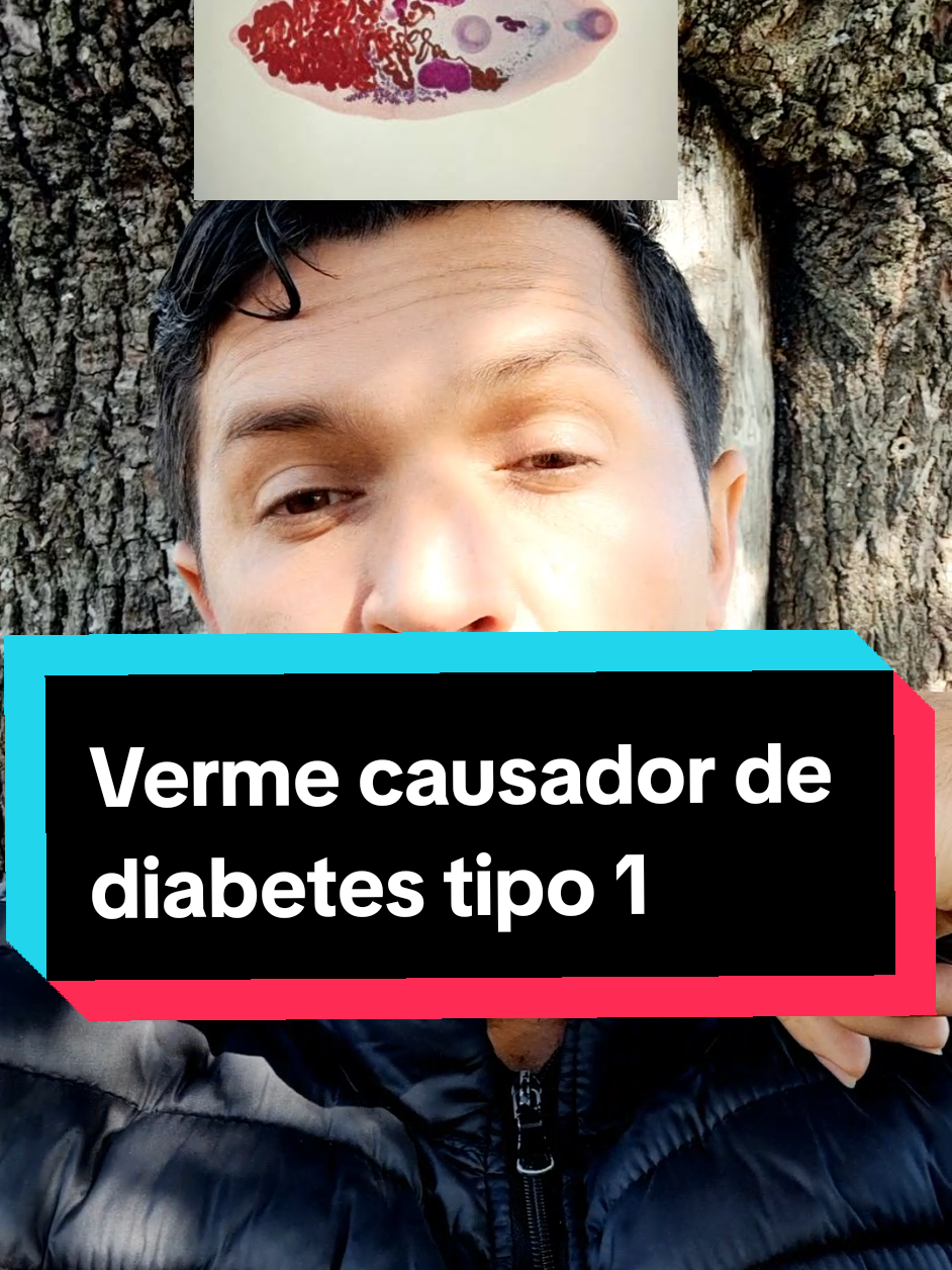 Verme causador de diabetes tipo 1. #saude #verme #diabetes #intestino #doenca #flypシ #viraliza 