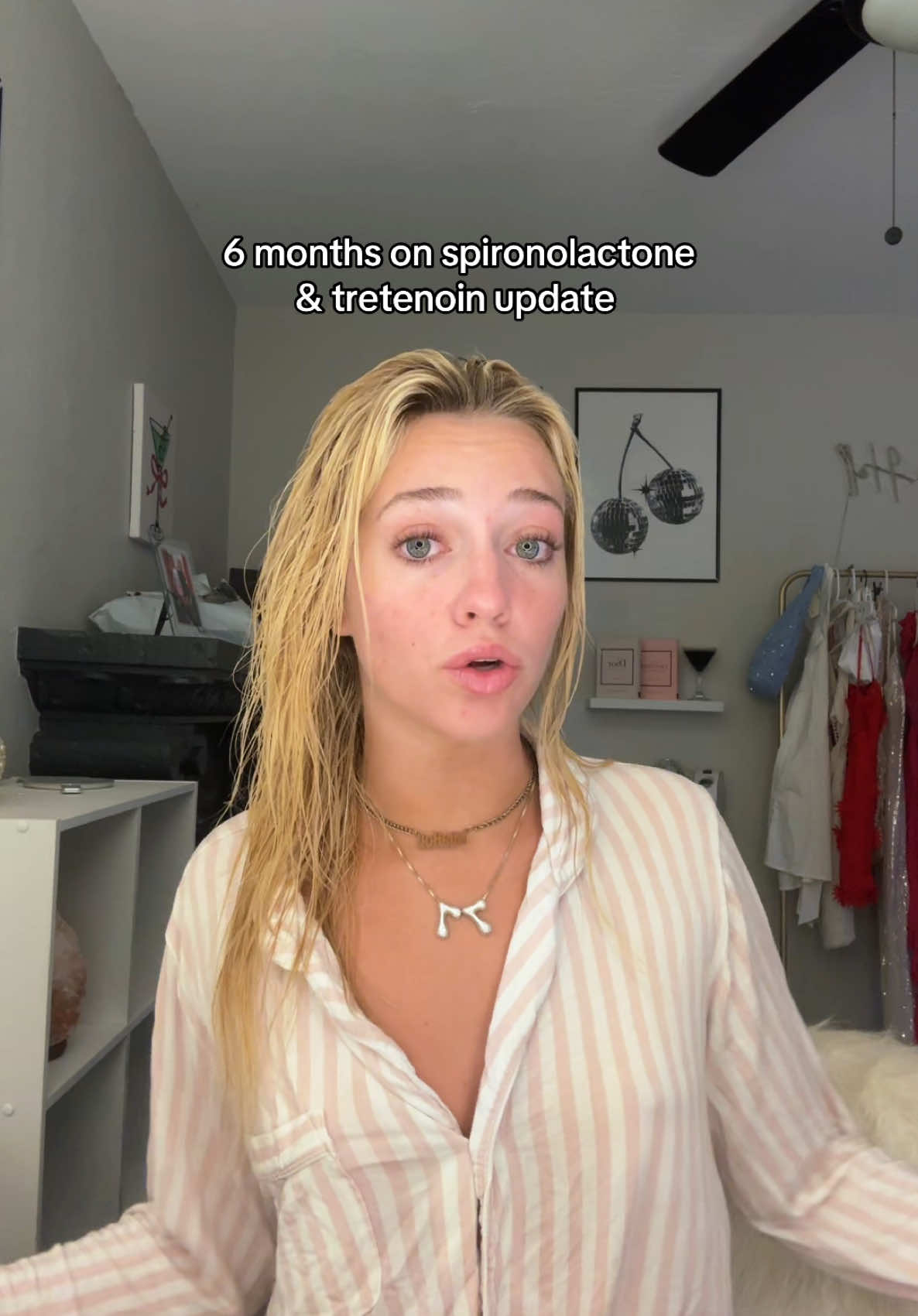 Replying to @Morgan Businger I love answering acne questions cause I been through it all so lmkkkkk #acnejourney #skincare #tretenoin #spironolactone 