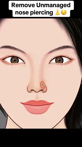 ASMR Remove Unmanaged nose piercing #nose #nosepainting #nosejob #nosey #nosepimple #nosepiecercing #piercing #nosecare 