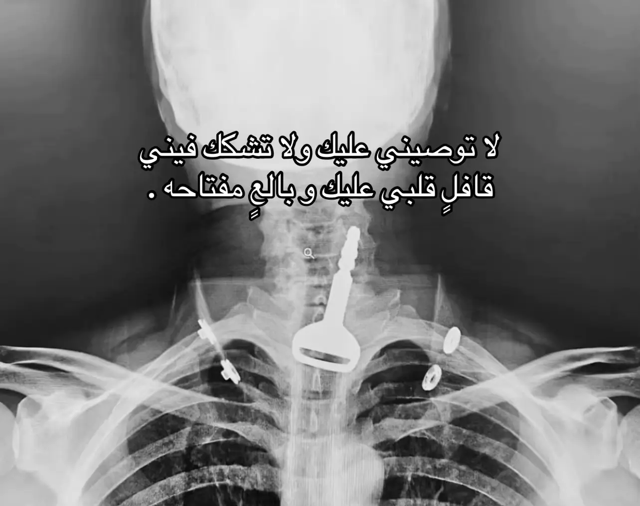 #fyp #al3nzi 
