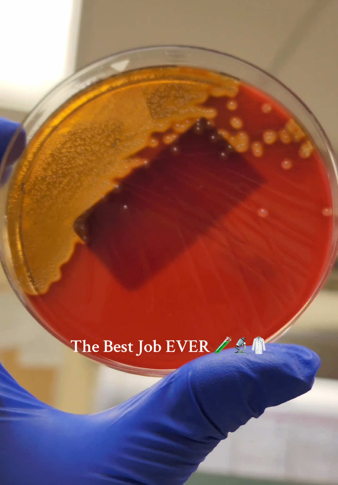 Medical Laboratory Scientist 🧪🔬🥼 these are just some of the incredible things that we get to see and analyze as medical laboratory scientists!  Join my community of CLS Students on Skool. We have weekly study sessions to help you effectively study for and pass your ASCP exam on the first try. The link is located in my bio. 📚🧪🧫🦠🔬 #healthcare #medicine #medtech #medicalhumor #medicaltechnologist #doctor #wellness #healthcareworker #scienceexperiments #laboratory #laboratorio #science #biomedicina #microscope #nurse  #trendingnow #explorepage #iykyk ##scientist##sciencetok