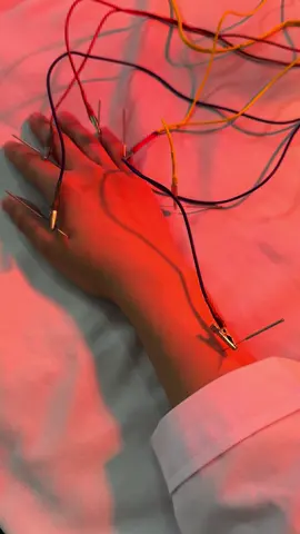 Châm cứu nhiều cho bệnh nhân nên tê tay. Kết quả là bác sĩ dô châm cứu luôn 😂 #dongy #bv2p