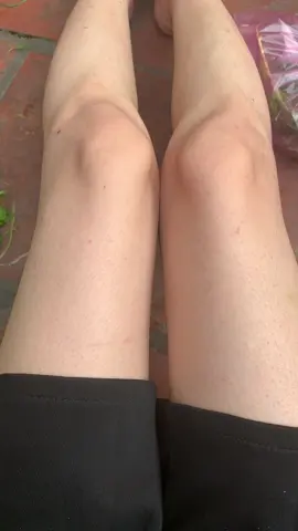 Ahihi mặc váy ngắn ra đường rồi các bà ơiiiiiii🤣#daysungnanglong #viemnanglong #keratosispilaris #xuhuongtiktok 