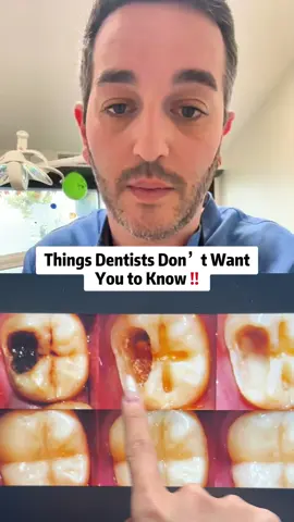 First time trying chewable toothpaste tablets 🦷 prioritize your dental health with (NOBS) #nobstoothpaste #nobs #chewabletooth #refesy 