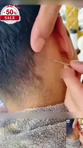 Đừng nặn mụn bằng tay nữa. Nó có mùi dễ chịu hơn không?