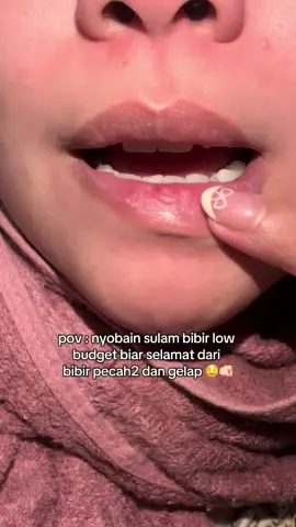 selamat dari sulam bibir 😭🫵🏻😝#fyp#lipcare#4u 