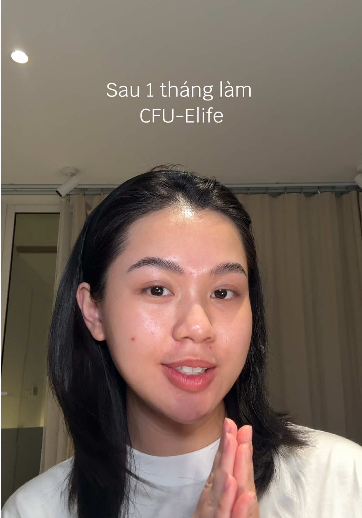 Review cảm nhận sau 1 tháng làm phương pháp CFU elife 😝 #goclamdep #reviewlamdep #cfu #hifu #thammy #facialtreatment 