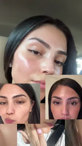 on my skin journey - the difference is crazy after one session i cant wait to the rest like omg ?!! @Hendcosmetic invited #carbonpeel #facial #beautymaintenance #skincare #SelfCare 