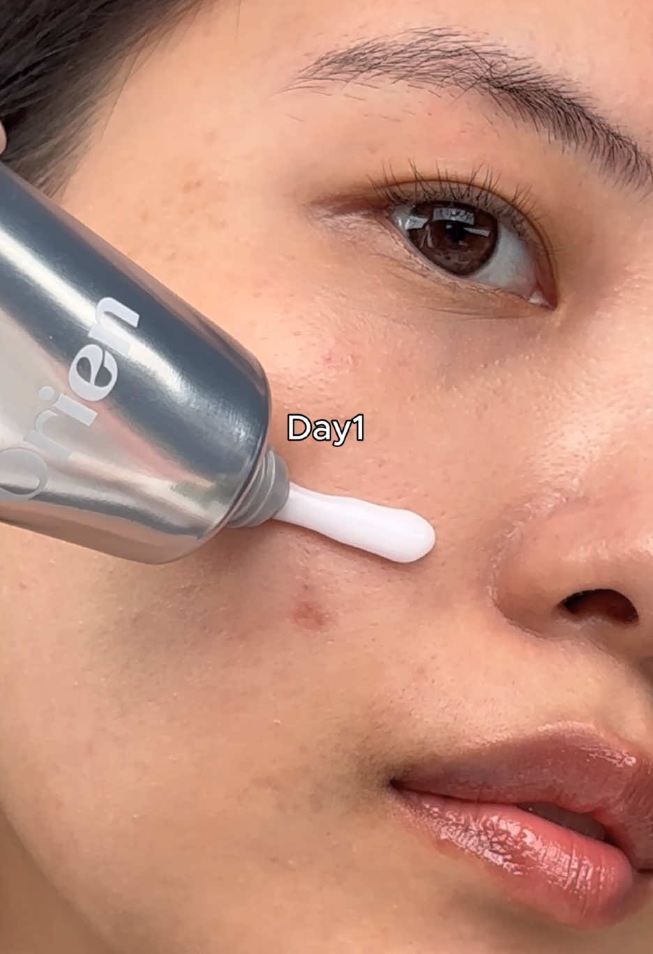 #clearskin #acnescartreatment #ultabeauty #orien #glowyskin #skincareproducts #skincarehacks #koreanskincare #darkspot #acnescar #spotcare 