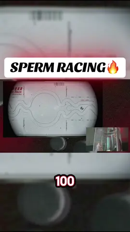 SPERM RACING🔥🔥 #fyp #f #fypviralシ゚ #a #shorts #shortsvideo #youtubeshorts #ytshorts #spermracing #sper #curlyhair #race #ucla 