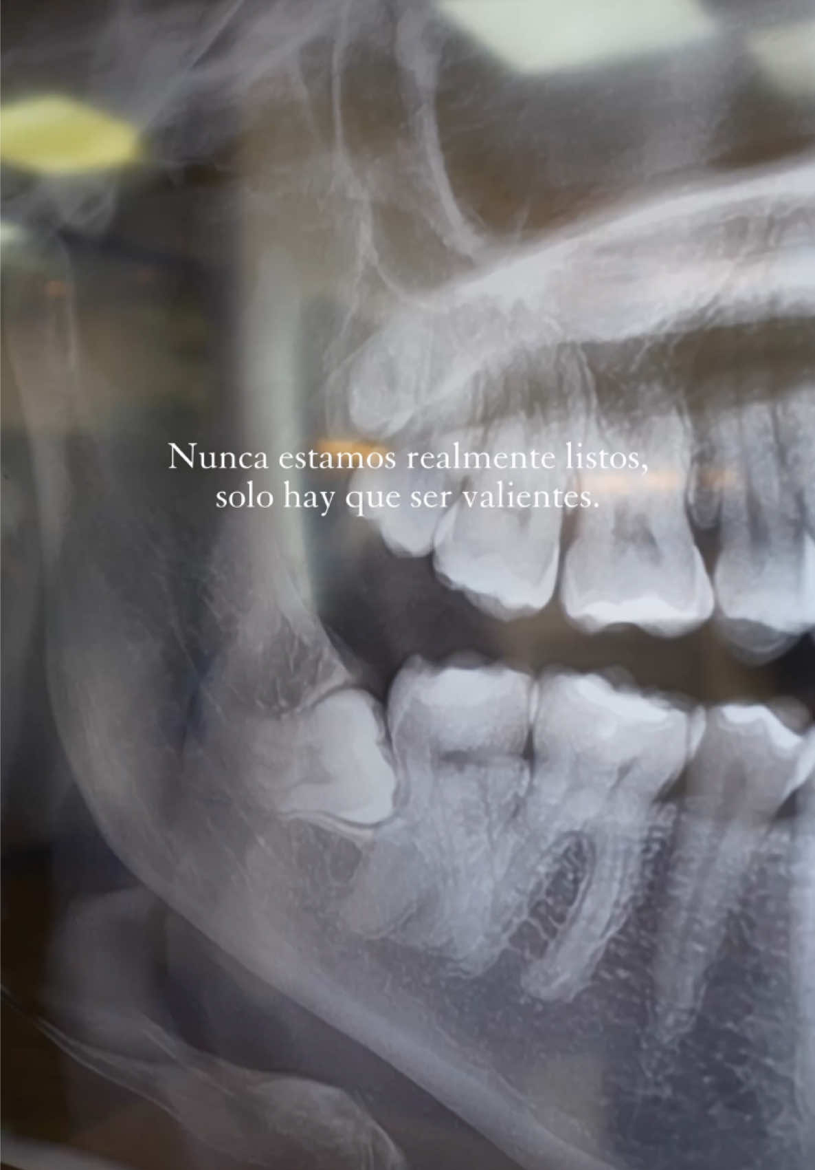 ❤️‍🩹 @dra.anniasanchez ✨ #muelasdeljuicio #wisdom #wisdomteeth 