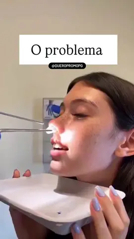 Comenta NARIZ, te envio o link desse achadinho para melhorar a respiração, Respire melhor instantaneamente! 🌬️👃 Diga adeus à respiração difícil! Com nosso dilatador nasal magnético, você amplia os canais nasais e melhora o fluxo de ar em segundos. Ideal para esportes, ronco ou simplesmente para respirar melhor no dia a dia! 🔥 Benefícios: ✅ Aumenta a entrada de ar ✅ Confortável e discreto ✅ Fácil de usar e reutilizável 🚀 Respire com mais facilidade agora! Peça já o seu. #respiração #respiracao #mulher