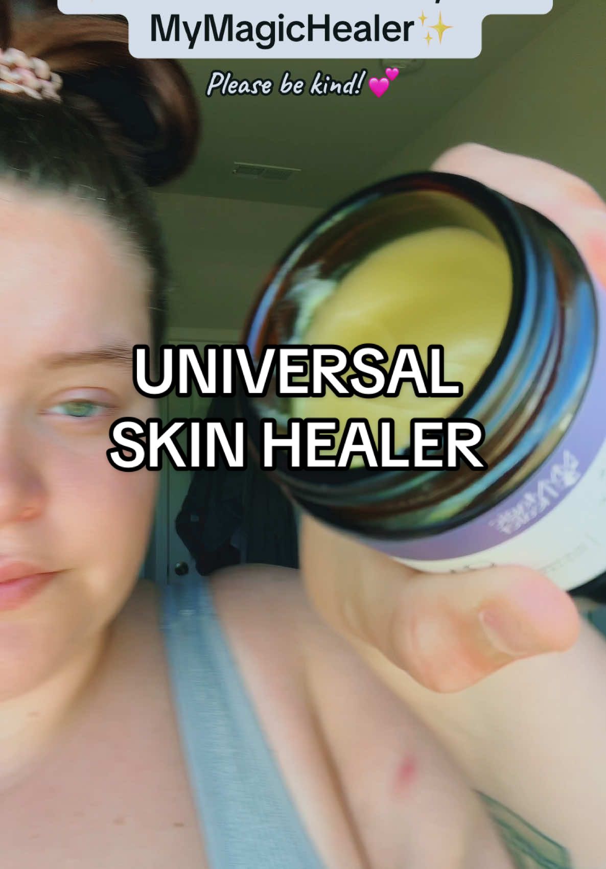 Replying to @pronouns:me fr ᖭི༏ᖫྀ ꩜ While some people see a reduction in flare ups when getting into a smaller body, some people have it worse! You don’t know someone’s “health” by looking at their body! I have gotten smaller and still struggled with HS! While I know being in a bigger body is seen as being unhealthy, I eat healthier than most small people that I know. My results at the Dr always come back great! I am just a larger person who has always been larger! Living with HS, I thought I'd never find hope, until I found MyMagicHealer! #hswarrior #hidradenitissuppurativa #hidradenitissuppurativaawareness #problematicskin #mymagichealer #cysticacne #flareup #flarecare #bodyacne #hs @mymagichealer_usa @MyMagicHealer 