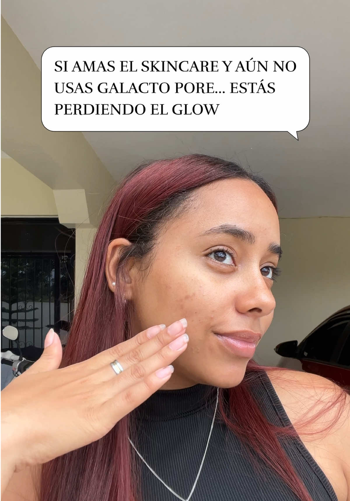 Siempre con @SAM’U 🤌🏼✨ #riceyeasttoner #ricetoner #pores #poreserum #sebum #samu #galactomyces # glassskin #cloggedpores 