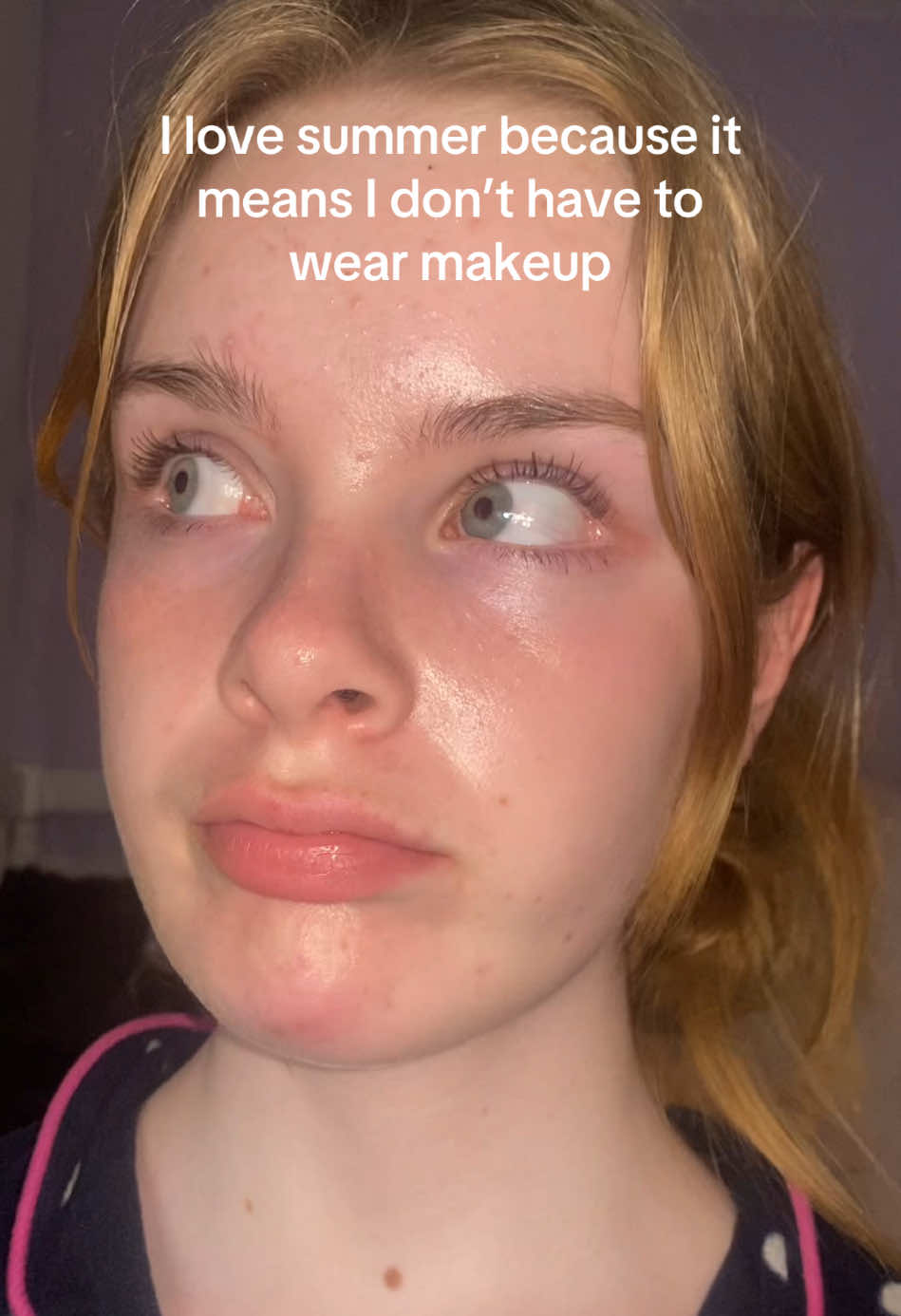 The cold makes my skin red 😔 #fyp #foryou #Summer #relatable #real #fr #makeup #nomakeup #viral #blowup #dejavu 