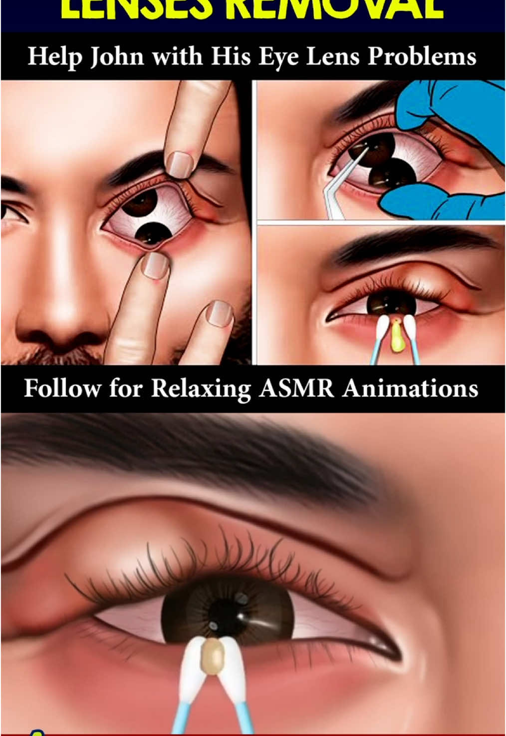 ASMR Animation | Eye Care | Contact Lens Removal | John Eye Lens Treatment | Calm Care Clinic #asmr #relaxing #calmcareclinic #cleaning  #eyes 