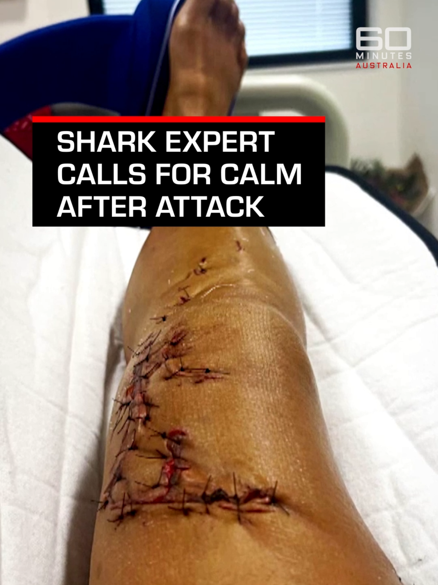 Despite concerns around shark sightings, shark ecologist Dr Amy Smoothey from the Department of Primary Industries and Regional Development suggests shark numbers are not increasing.  Watch the full story on our YouTube channel - link in our bio. #60Mins
