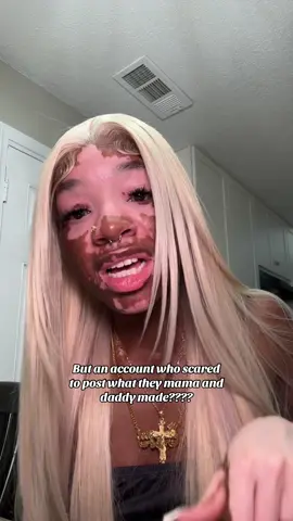 Let this serve as a reply to the 2,000+ comments in my last video calling me ugly, overly confident, egotistical, etc etc. NOW I MOVE ON cause everyone should feel like that about themselves, no? 🤨👀 | #fyp #vitiligo 